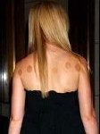 Gweneth-Paltrow-with-cupping marks